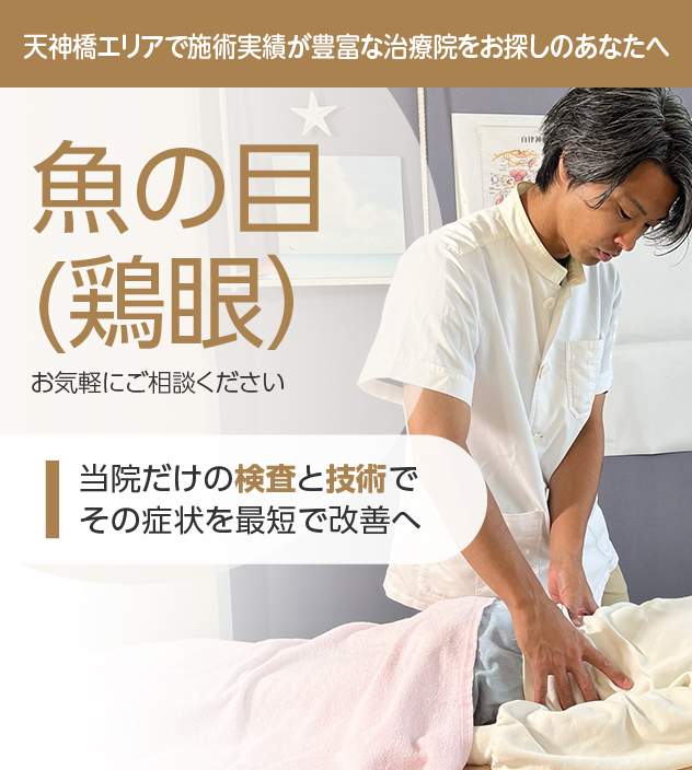 魚の目(鶏眼)
