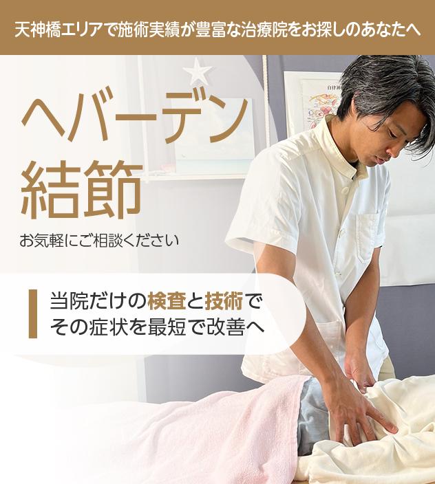 ヘバーデン結節