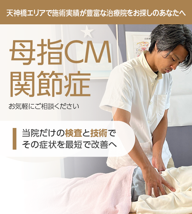 母指CM関節症