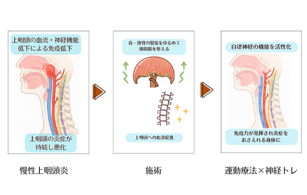 慢性上咽頭炎